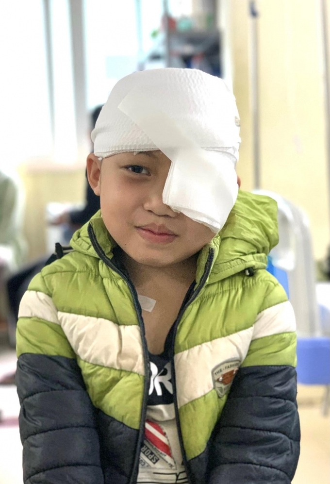 Cậu bé 8 tuổi người dân tộc Dao Lò Mạnh Q. với u máu khủng ở mắt được điều trị ổn định 