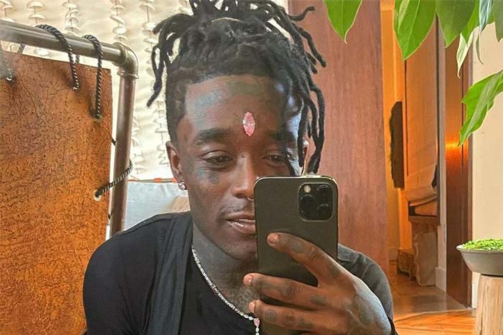 Viên kim cương bị giật khỏi trán của nam rapper - 2 Viên kim cương bị giật khỏi trán của nam rapper - 2