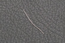 Người đàn ông sưng tấy cổ, phải phẫu thuật chỉ vì... hóc xương cá