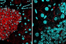 Khám phá ra cách ngăn chặn ung thư di căn
