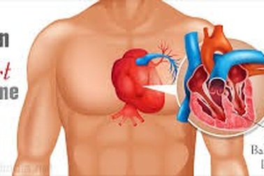 Hội chứng "trái tim vỡ": Tổn thương tim do stress