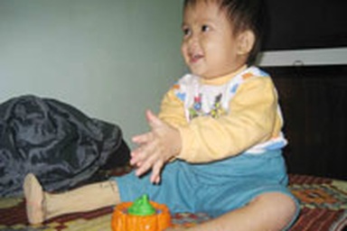 Cuộc sống mới của cháu bé bị súc vật cắn một phần cơ thể