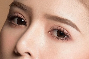 Cắt mí 5 ngày không nhắm được mắt, bác sĩ cảnh báo nguy cơ