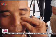 Chữa viêm xoang bằng cách bắt sâu trên mặt: Bác sĩ tai mũi họng nói gì?