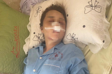 Giám định thương tật người phụ nữ bị cán bộ QLTT đánh đập vì ghen