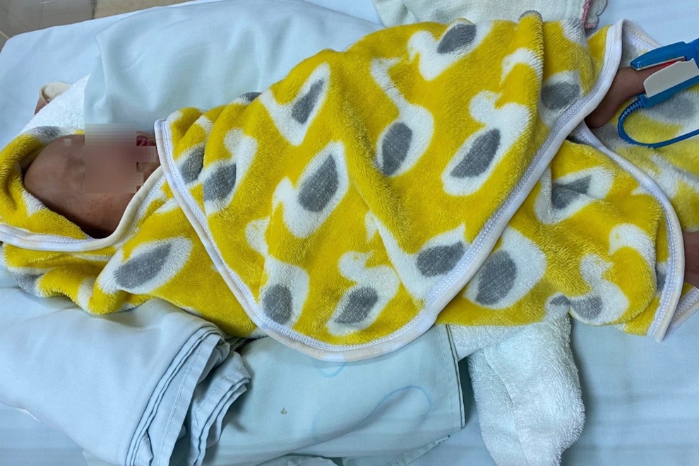 Can thiệp cứu thành công bệnh nhi 44 ngày tuổi tim bẩm sinh hiếm gặp - 2