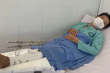 Thương 2 cha con gặp tai nạn gãy đùi trên đường về quê tránh dịch