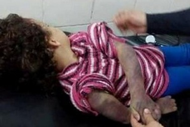 Bé gái 5 tuổi bị cha đánh chết vì không làm bài tập