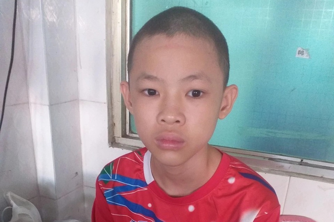 Thương cậu bé mồ côi 14 tuổi chỉ nặng 28kg vì khối u khủng ăn hết bên đùi - 4 Thương cậu bé mồ côi 14 tuổi chỉ nặng 28kg vì khối u khủng ăn hết bên đùi - 4