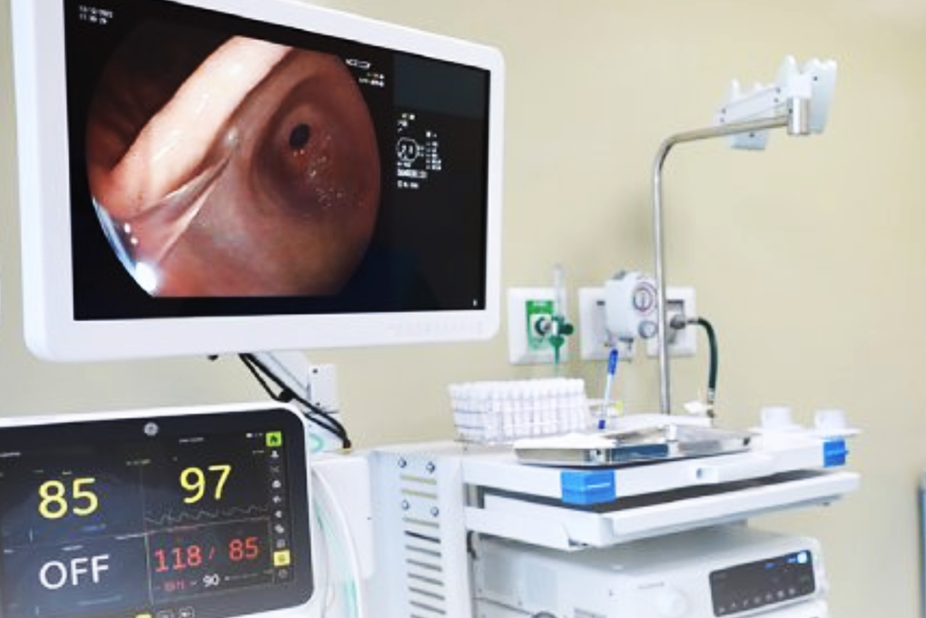 Người phụ nữ ở TPHCM phải cấp cứu trong đêm sau bữa cơm với cá điêu hồng - 1 Người phụ nữ ở TPHCM phải cấp cứu trong đêm sau bữa cơm với cá điêu hồng - 1