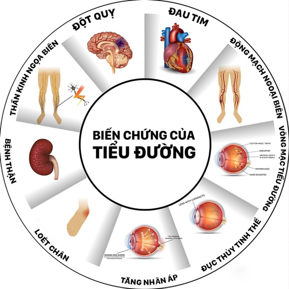 Biến chứng tiểu đường và đột phá 100% dây thìa canh lá to - 2 Biến chứng tiểu đường và đột phá 100% dây thìa canh lá to - 2