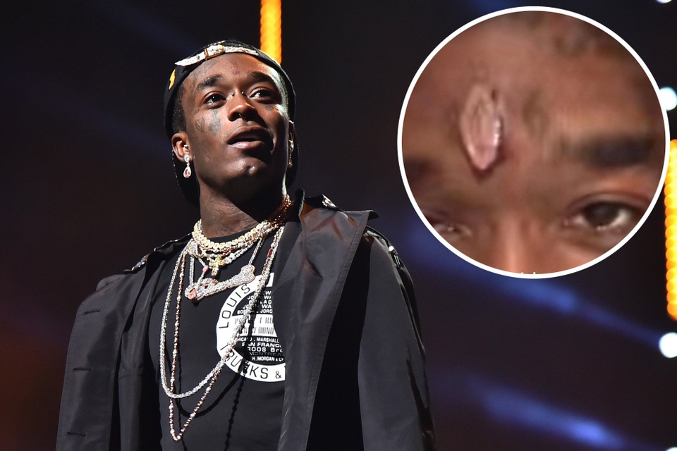 American rapper shocked when he put a 24 million USD diamond on his forehead - 1