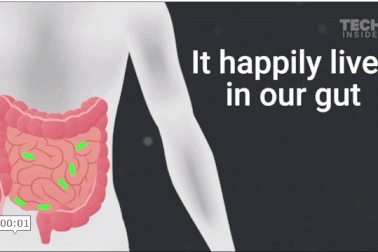 Bệnh nhiễm trùng chết người từng chỉ có trong bệnh viện hiện đã lan ra cộng đồng