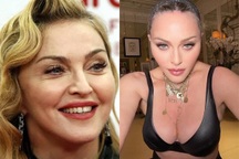 Madonna khác lạ trong loạt ảnh chỉnh sửa "quá đà"