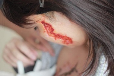 “Hoạn thư” xăm hình 3 con rết lên mặt và ngực thiếu nữ hầu tòa