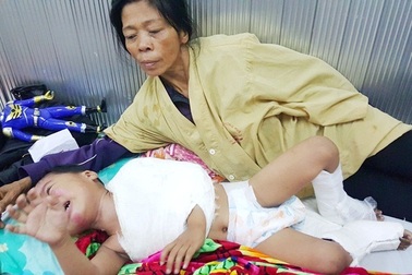 Thương bé 3 tuổi gãy hai chân, mất cả bố lẫn mẹ sau khi bị ô tô khách đâm