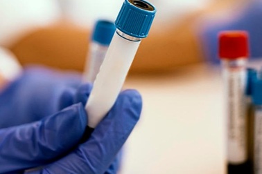 Công ty Mỹ hoàn thành lô vắc-xin thử nghiệm đầu tiên chống virus corona