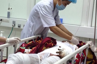 Đi đốt rẫy, một  phụ nữ bị  bỏng trên 90% cơ thể