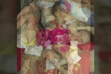 Xót thương bé gái đang khoẻ mạnh bỗng đổ "bệnh lạ" người chỉ còn da bọc xương