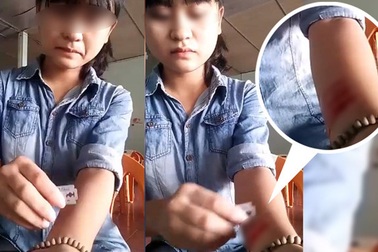 ​Người trẻ ngược đãi bản thân