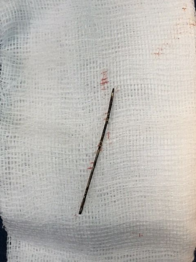 te