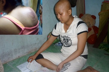 Khát vọng sống của cô gái bị ung thư xương