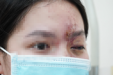 Chánh Thanh tra Sở Y tế TPHCM: Hoạt động "lấn sân" gây tai biến thẩm mỹ