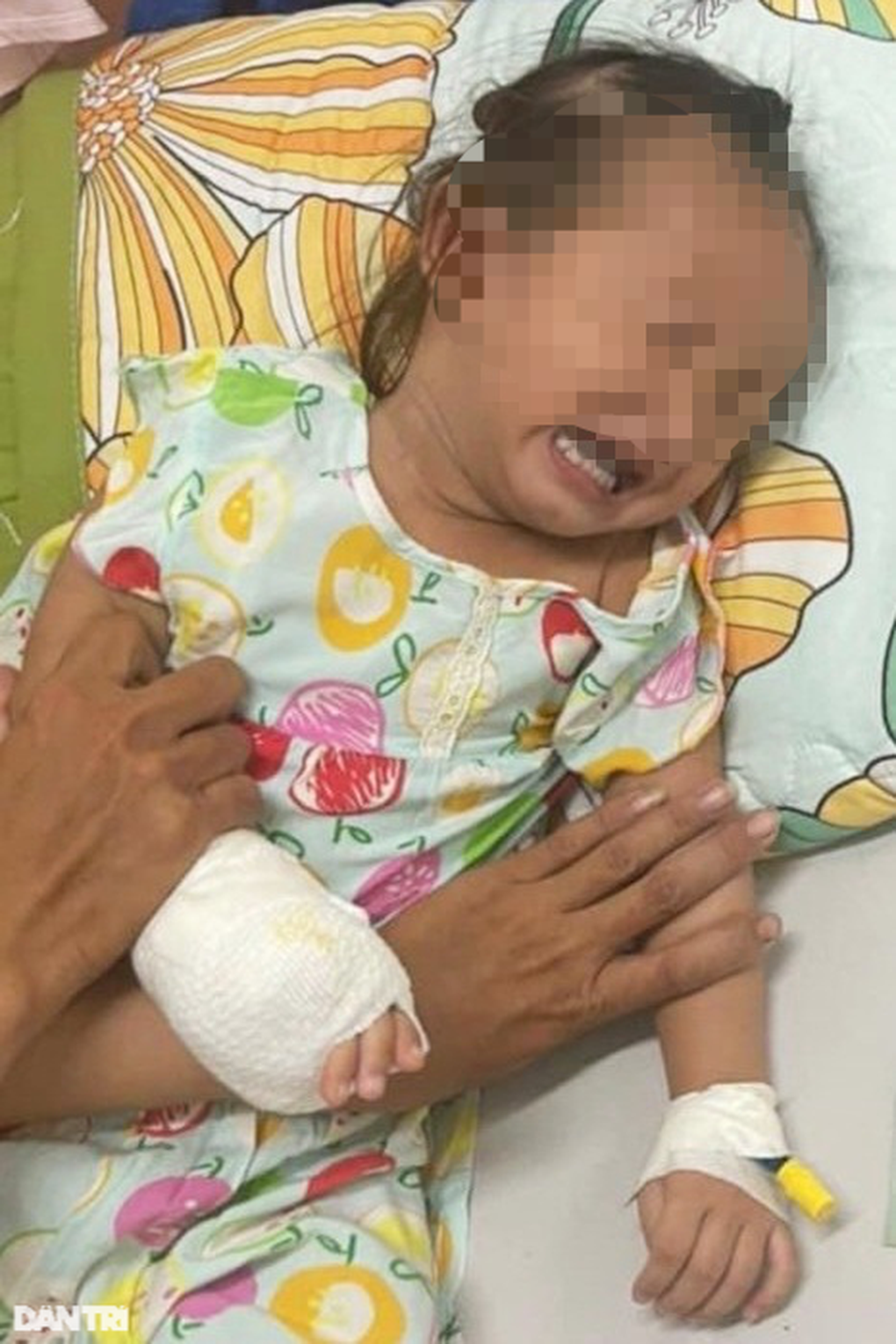 TPHCM: Bé gái 2 tuổi bỏng thương tâm vì đưa tay vào bóng đèn đang cắm điện - 1 TPHCM: Bé gái 2 tuổi bỏng thương tâm vì đưa tay vào bóng đèn đang cắm điện - 1