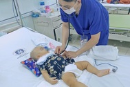 Trượt chân ngã cầu thang, bé trai 11 tháng tuổi bị kéo đâm trúng đầu