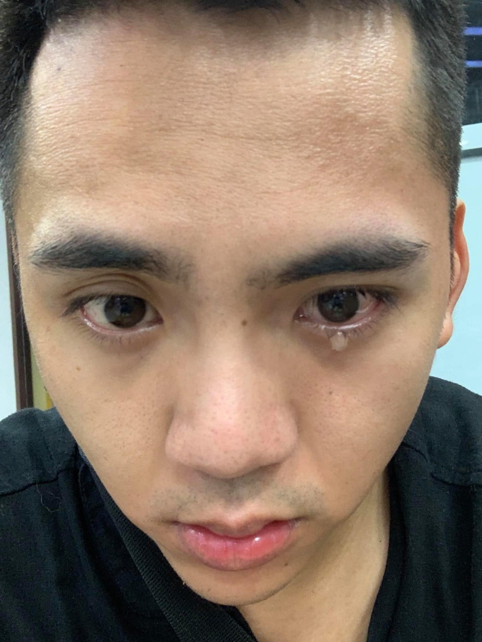 Lời cảnh tỉnh của chàng Youtuber sau hành trình chữa trúng gió méo miệng - 1 Lời cảnh tỉnh của chàng Youtuber sau hành trình chữa trúng gió méo miệng - 1