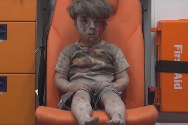 Nhói lòng hình ảnh cậu bé bị thương sau cuộc không kích ở Syria