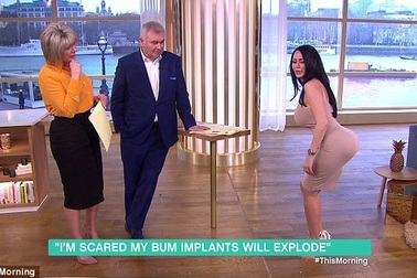 Nổi tiếng “bất đắc dĩ” vì… phẫu thuật thẩm mỹ hỏng