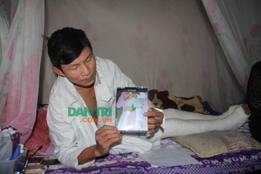 Rùng mình nam MC đám cưới bị trận đòn nhừ tử vì nghi… trộm chó