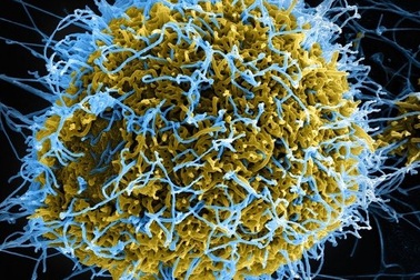 Những nơi trú ẩn không ngờ của virus trên cơ thể người