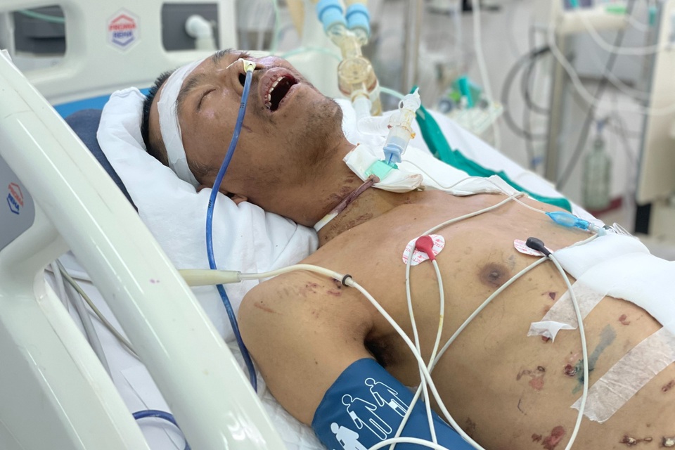 Thương cảnh người vợ ăn gói xôi 10 nghìn đồng chia 2 bữa cầu xin cứu chồng - 1 Thương cảnh người vợ ăn gói xôi 10 nghìn đồng chia 2 bữa cầu xin cứu chồng - 1