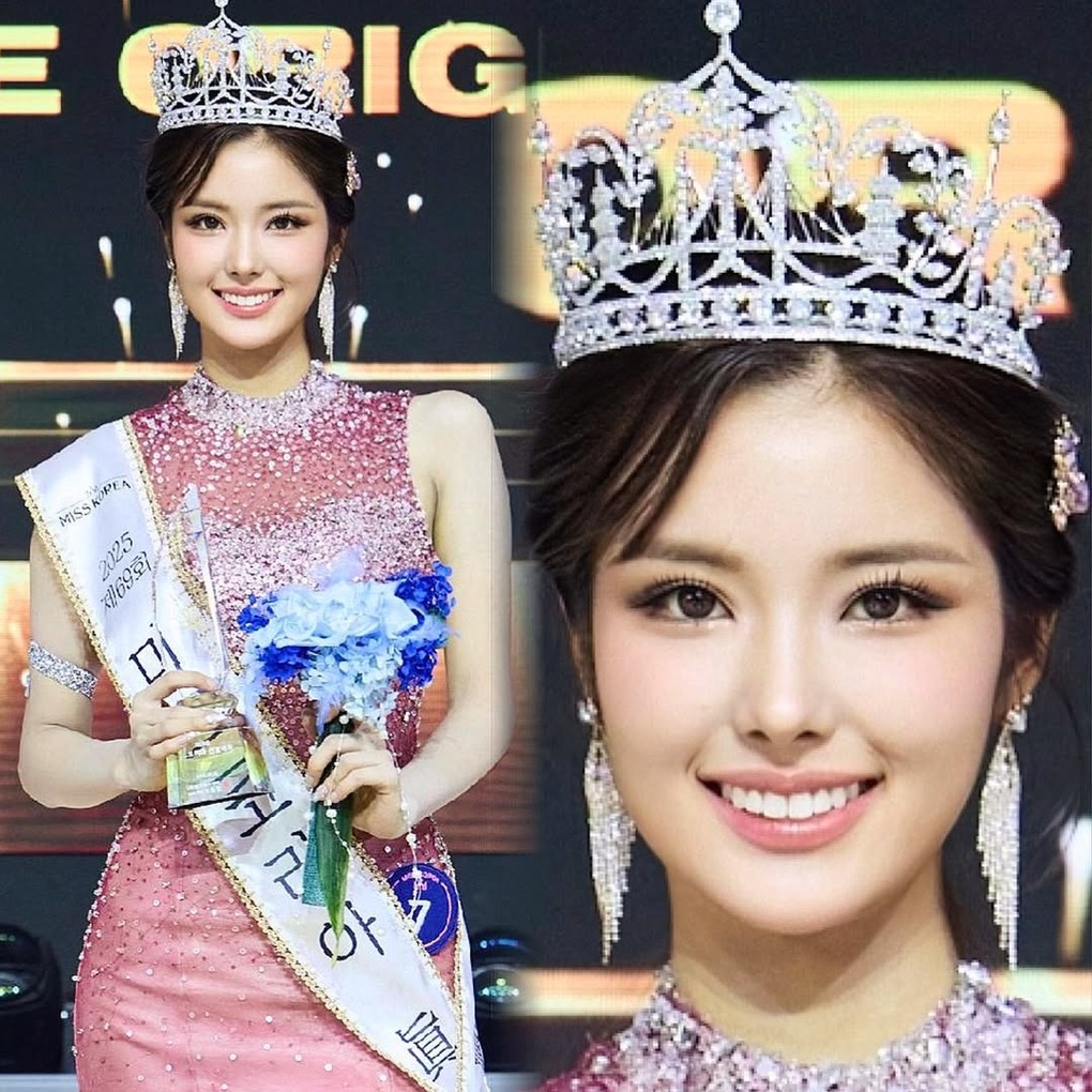 La nouvelle Miss Corée saluée pour sa beauté digne d'une « poupée vivante » - 1 Hoa hậu mới đăng quang của Hàn Quốc được khen đẹp như “búp bê sống” - 1