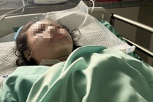 Hơn 10 bác sĩ căng não cứu cô gái ở TPHCM bị container cán ngang thân dưới