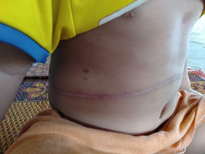 Không cam chịu con gái 3 tuổi chết mòn vì bệnh tật, vợ chồng nghèo sang Lào nhặt phế liệu kiếm tiền chữa bệnh cho con - Ảnh 5. Không cam chịu con gái 3 tuổi chết mòn vì bệnh tật, vợ chồng nghèo sang Lào nhặt phế liệu kiếm tiền chữa bệnh cho con - Ảnh 5.