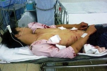 Án mạng nghiêm trọng làm 2 người chết, 2 người trọng thương