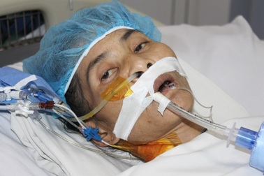 Mẹ đơn thân người dân tộc Mường nguy kịch vì suy tim nặng