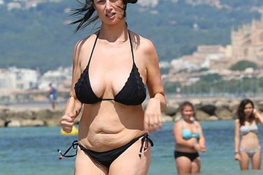 Sốc với thân hình chảy sệ của người mẫu nổi tiếng nước Anh