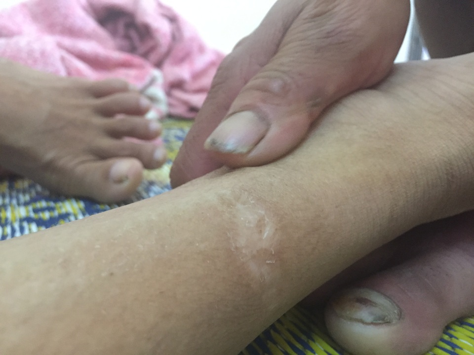 Người cha đau đớn vì vết xích nơi cổ chân con - 3 Người cha đau đớn vì vết xích nơi cổ chân con - 3