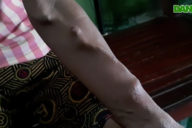 Cuộc đời bế tắc của người đàn bà biến cố.