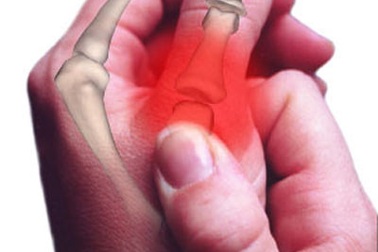 Biểu hiện của bệnh viêm khớp xương mãn tính