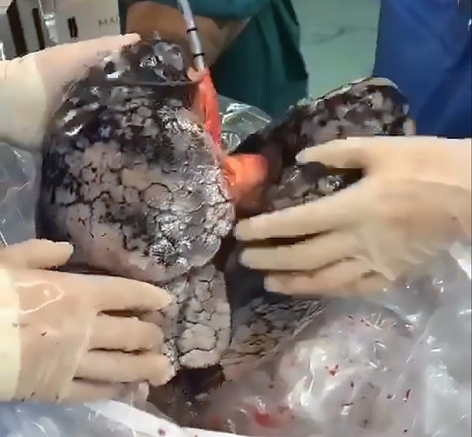 “Ám ảnh” lá phổi đen kịt của người 30 năm nghiện thuốc lá - 2 “Ám ảnh” lá phổi đen kịt của người 30 năm nghiện thuốc lá - 2