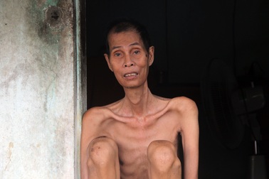 Thương người đàn ông gầy nhất vùng trong ngôi nhà 4 mảnh đời nghèo bền vững