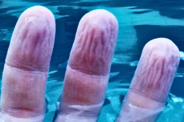 Đã tìm ra lời giải cho câu hỏi "vì sao ngón tay nhăn nếu ngâm nước lâu?"