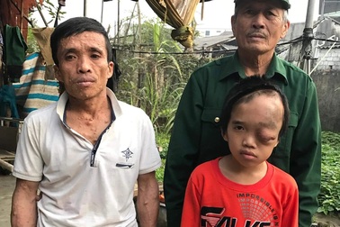 Người cựu binh "tuyến lửa" không sợ bom đạn hằng đêm nằm ôm con khóc