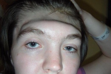 Cô gái mất trán vì thói quen nguy hiểm khi lái xe