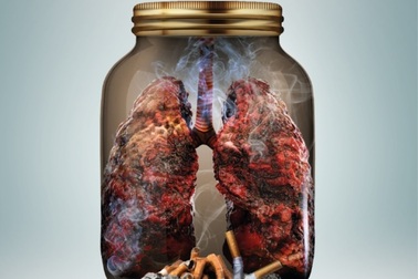 Nguy cơ tử vong do các bệnh về phổi liên quan đến sử dụng thuốc lá